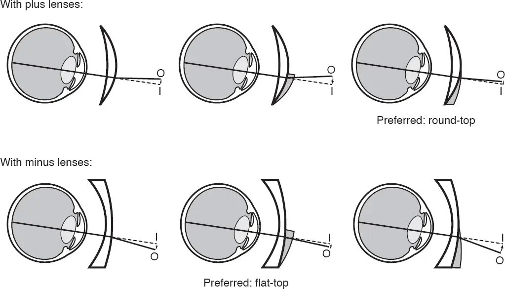 bifocal datar-top lénsa round-top